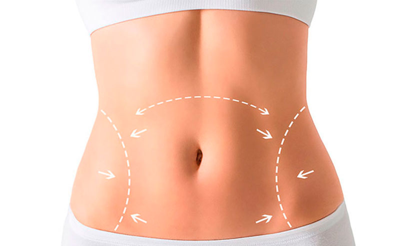 Vascular em Atibaia - Clínica JCG Clínica de Abdominoplastia em Atibaia